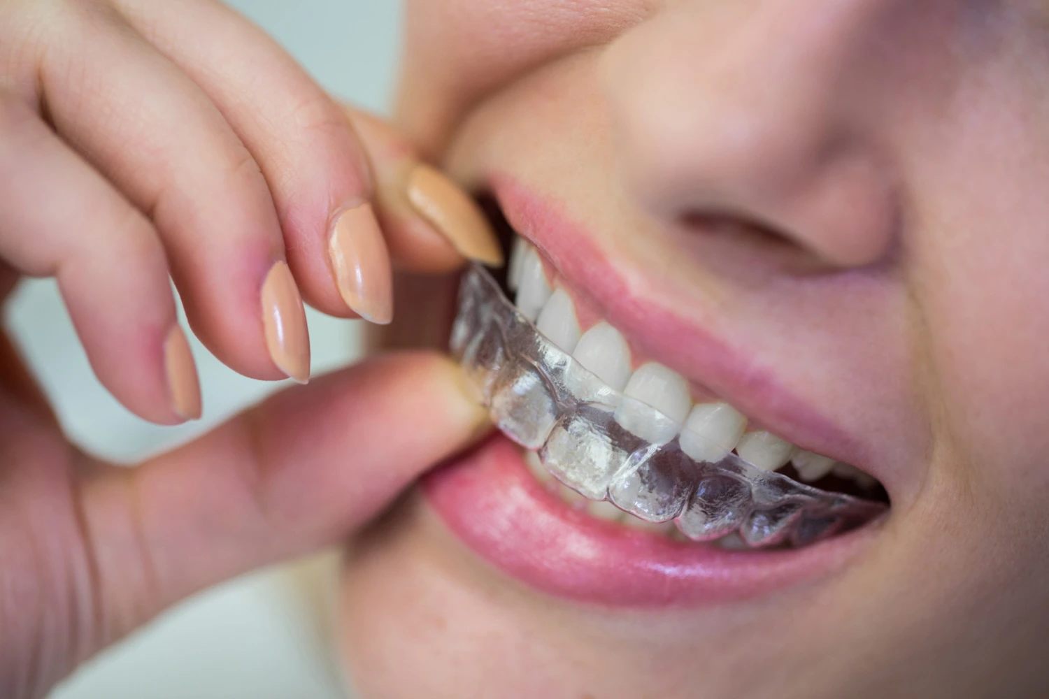 orthodontics in dubai